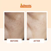 Image of InBeauty at Block 441A Clementi Ave 3 #01-08 Clementi Towers Singapore 121441