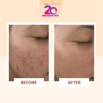 Image of InBeauty at Block 441A Clementi Ave 3 #01-08 Clementi Towers Singapore 121441